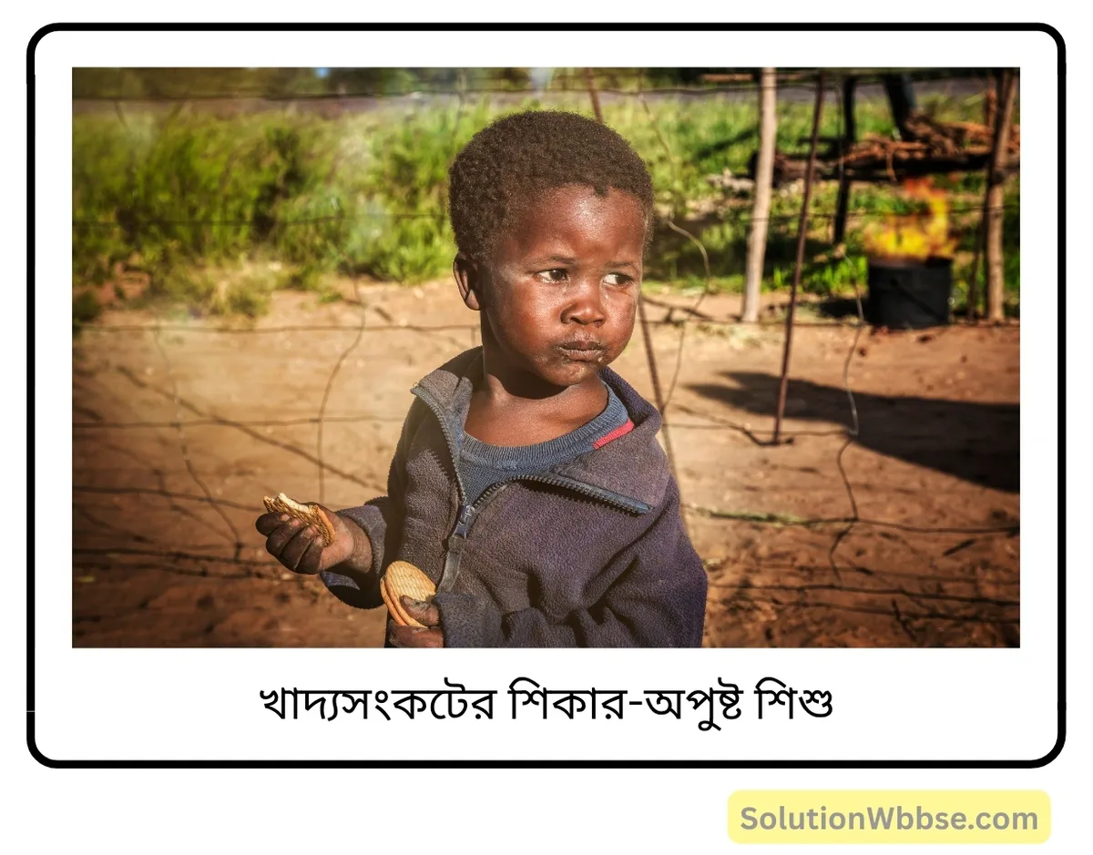 মাধ্যমিক জীবন বিজ্ঞান – পরিবেশ তার সম্পদ এবং তাদের সংরক্ষণ – পরিবেশ এবং মানব জনসমষ্টি – রচনাধর্মী প্রশ্নোত্তর 3 অপুষ্ট শিশু