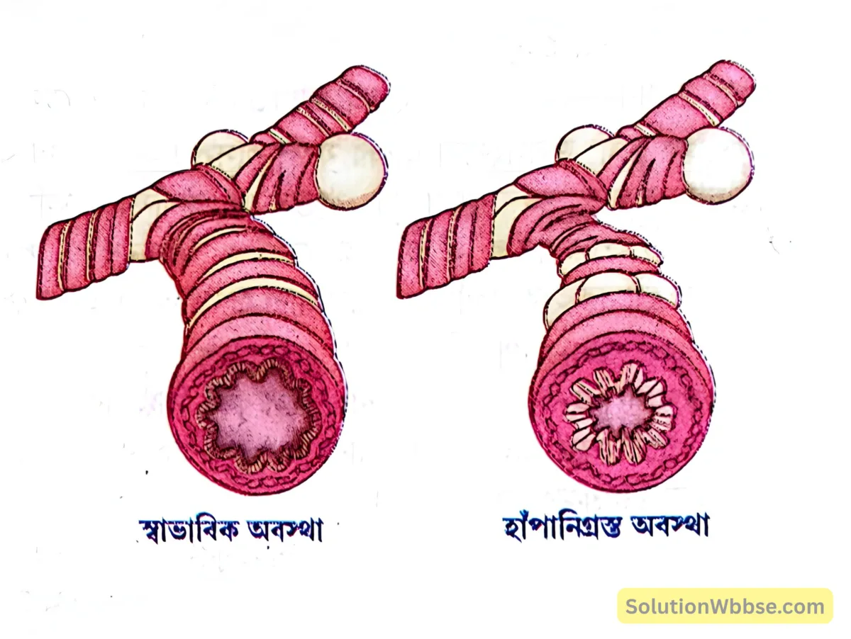 মাধ্যমিক জীবন বিজ্ঞান – পরিবেশ তার সম্পদ এবং তাদের সংরক্ষণ – পরিবেশ এবং মানব জনসমষ্টি – রচনাধর্মী প্রশ্নোত্তর 4 ব্রংকাইটিসে শ্বাসনালীর পরিবর্তন