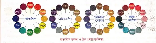 বর্ণান্ধতার লক্ষণ ও কারণ লেখো।