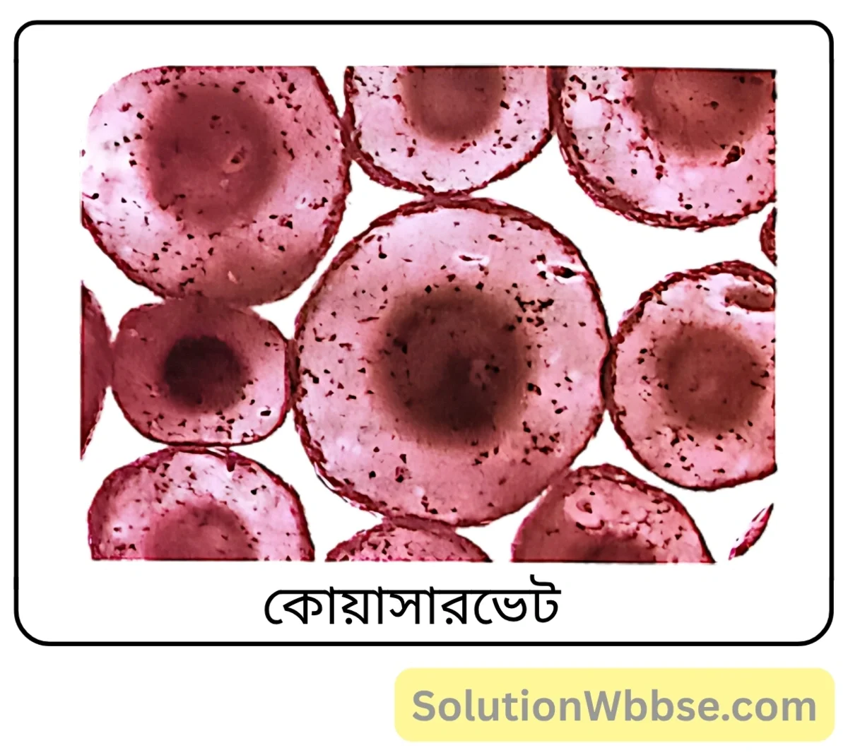 মাধ্যমিক জীবন বিজ্ঞান – অভিব্যক্তি ও অভিযোজন – অভিব্যক্তি – সংক্ষিপ্ত প্রশ্নোত্তর 2 কোয়াসারভেট কী