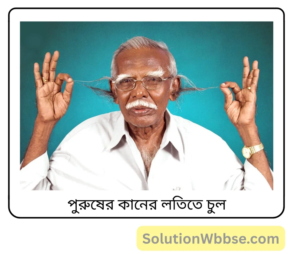 মাধ্যমিক জীবন বিজ্ঞান – বংশগতি এবং কয়েকটি সাধারণ জিনগত রোগ – বংশগতি – অতিসংক্ষিপ্ত প্রশ্নোত্তর 6 পুরুষের কানের লতিতে চুল