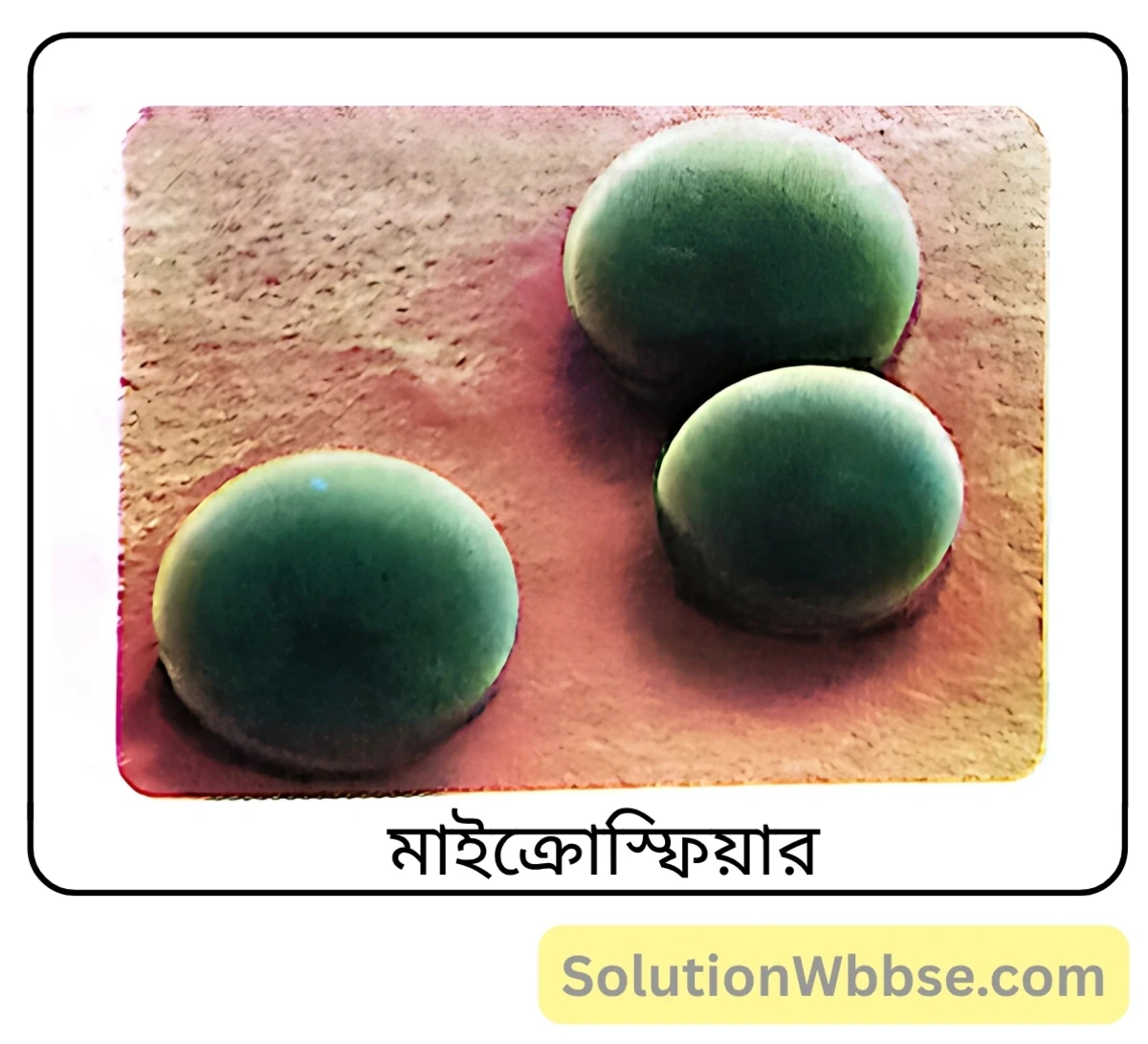 মাধ্যমিক জীবন বিজ্ঞান – অভিব্যক্তি ও অভিযোজন – অভিব্যক্তি – সংক্ষিপ্ত প্রশ্নোত্তর 3 মাইক্রোস্ফিয়ার কী