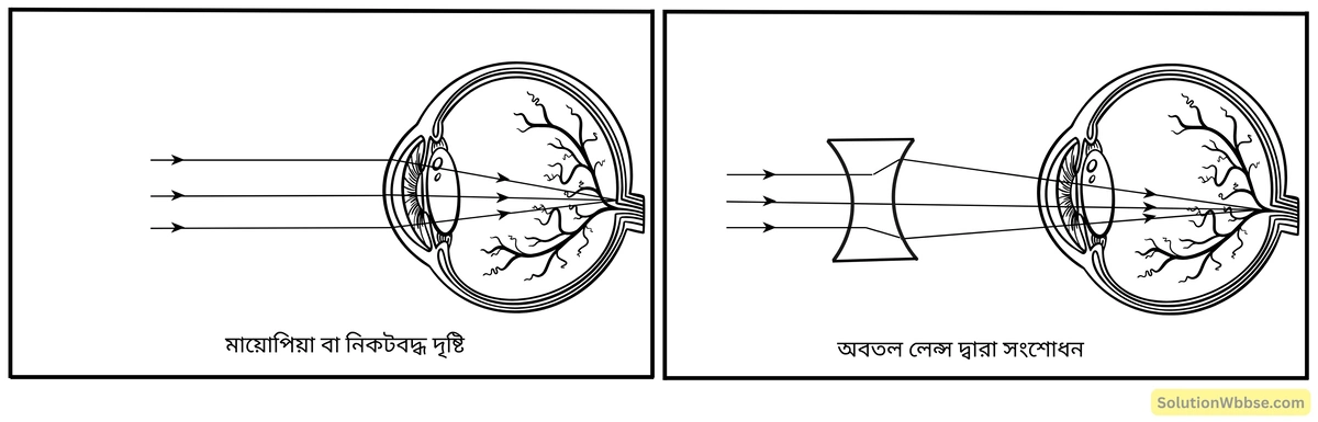 মাধ্যমিক জীবন বিজ্ঞান – জীবজগতে নিয়ন্ত্রণ ও সমন্বয় – প্রাণীদের সাড়াপ্রদান ও ভৌত সমন্বয় - স্নায়ুতন্ত্র - রচনাধর্মী প্রশ্নোত্তর 15 মায়োপিয়া-ত্রুটি ও সংশোধন-