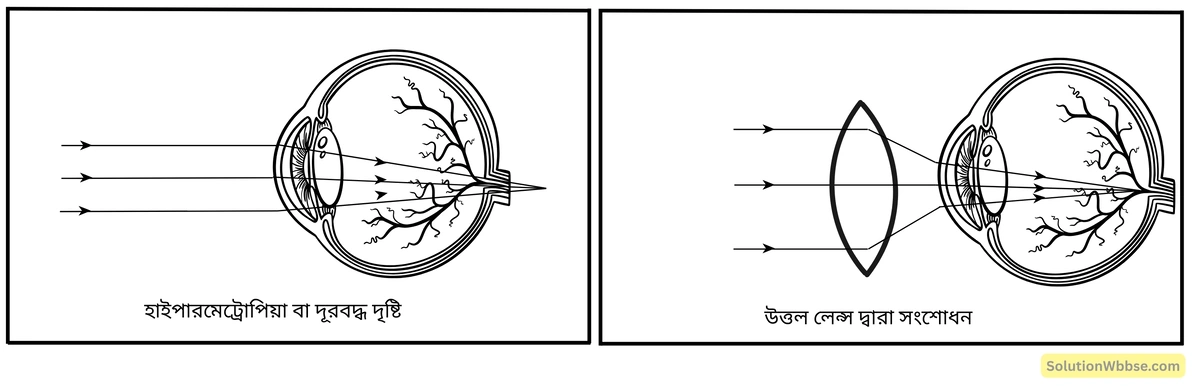মাধ্যমিক জীবন বিজ্ঞান – জীবজগতে নিয়ন্ত্রণ ও সমন্বয় – প্রাণীদের সাড়াপ্রদান ও ভৌত সমন্বয় - স্নায়ুতন্ত্র - রচনাধর্মী প্রশ্নোত্তর 17 হাইপারমেট্রোপিয়া-ত্রুটি ও সংশোধন-