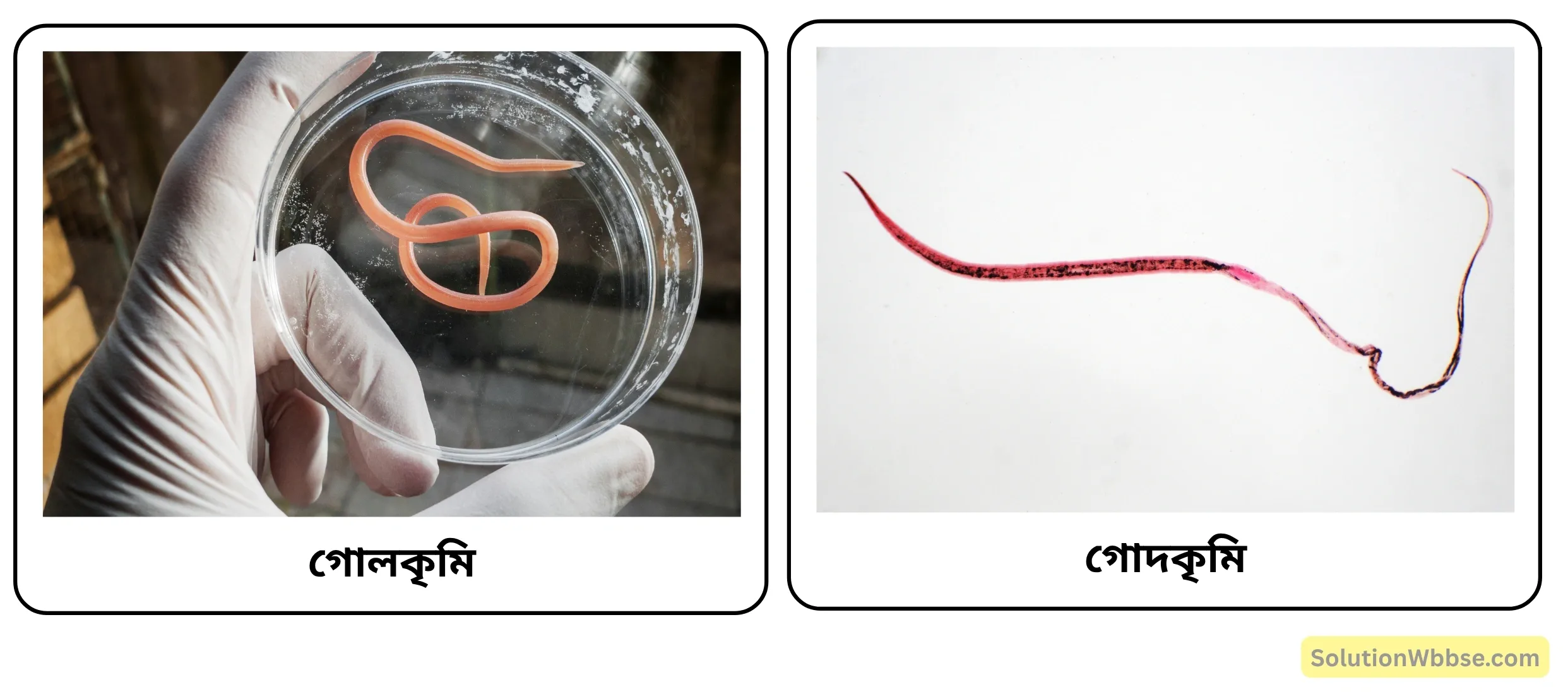 গোলকৃমি ও গোলকৃমি