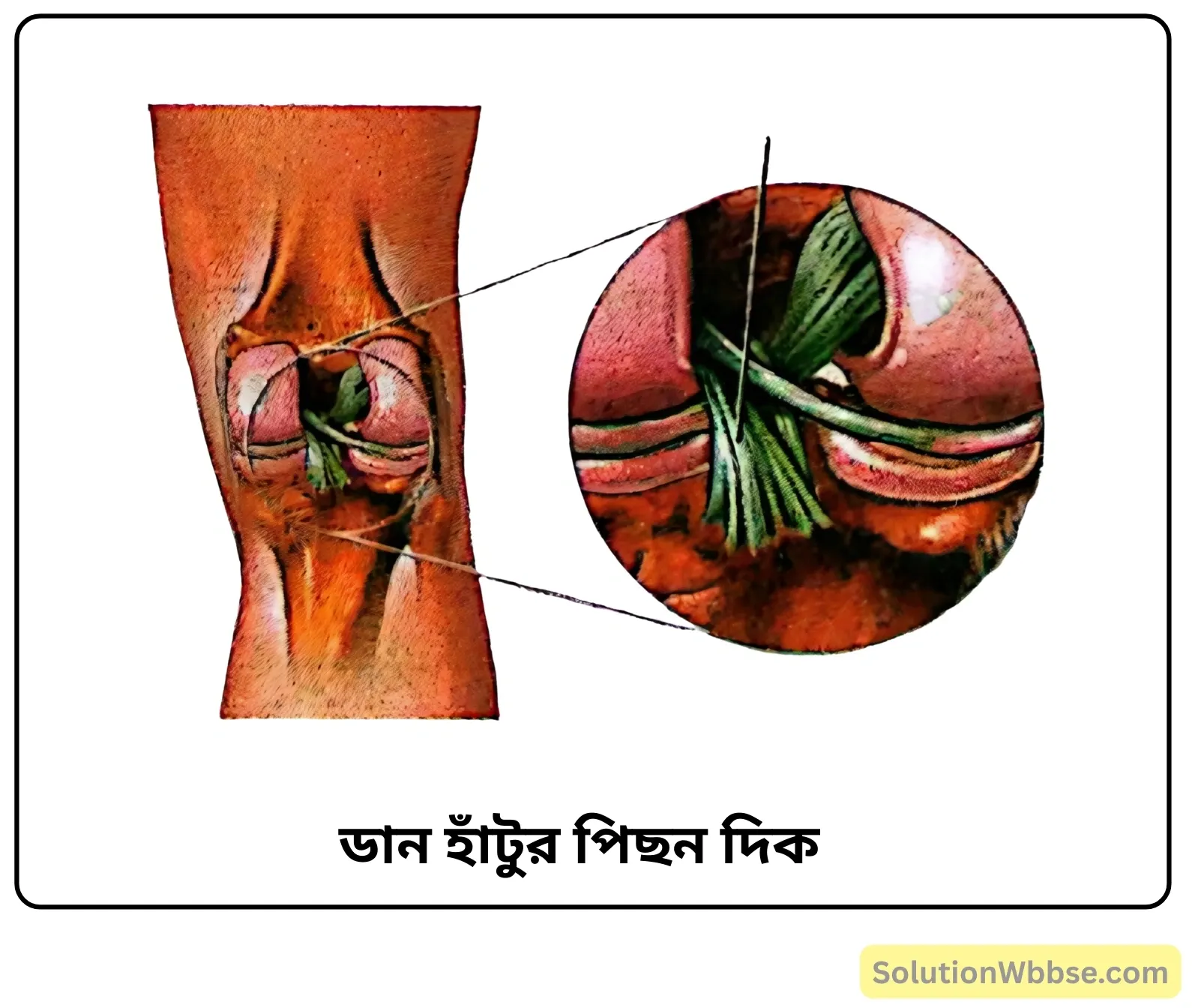 নবম শ্রেণী জীবনবিজ্ঞান - জীবন সংগঠনের স্তর - কলা - সংক্ষিপ্ত প্রশ্ন ও উত্তর 2 ডান হাঁটুর পিছন দিক