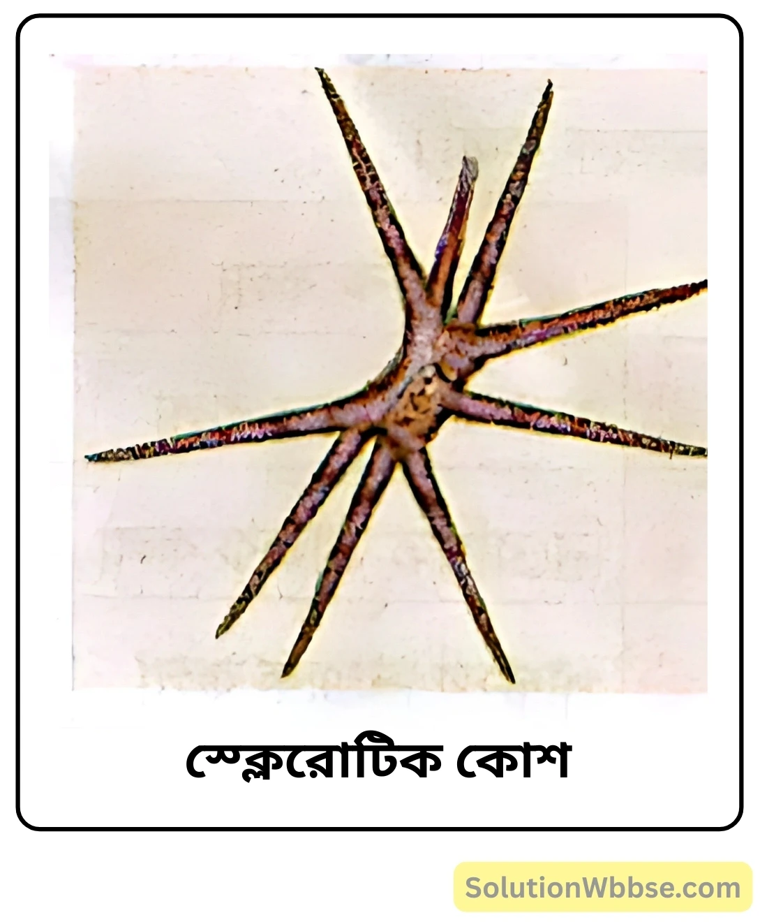 স্ক্লেরোটিক কোশ স্ক্লেরোটিক কোশ