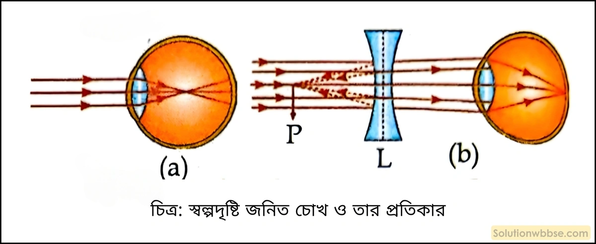 মাধ্যমিক ভৌতবিজ্ঞান - আলো - লেন্স, আলোর বিচ্ছুরণ, মানুষের চোখ ও আলোক তরঙ্গ 16 স্বল্পদৃষ্টি জনিত চোখ ও তার প্রতিকার