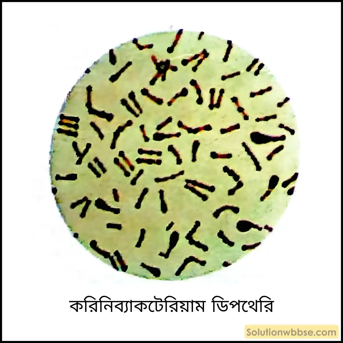 নবম শ্রেণী জীবনবিজ্ঞান - জীববিদ্যা ও মানবকল্যাণ - রচনাধর্মী প্রশ্ন ও উত্তর 8 করিনিব্যাকটেরিয়াম ডিপথেরি