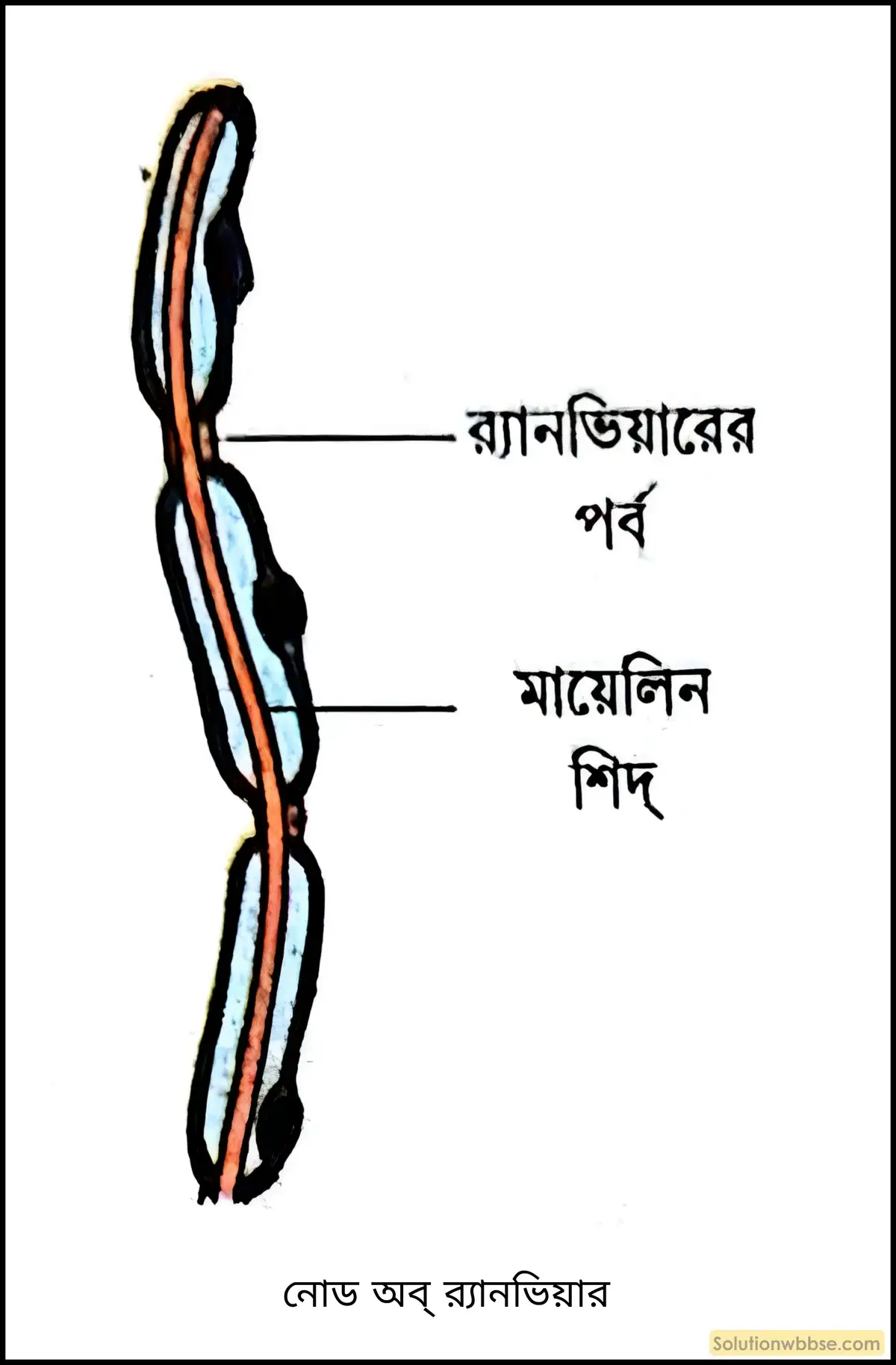 নোড অব্ র‍্যানভিয়ার