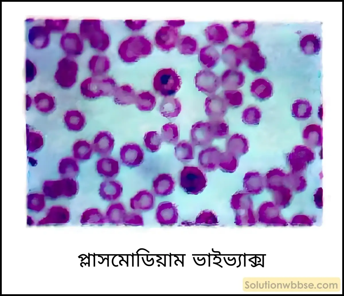 নবম শ্রেণী জীবনবিজ্ঞান - জীববিদ্যা ও মানবকল্যাণ - রচনাধর্মী প্রশ্ন ও উত্তর 7 প্লাসমোডিয়াম ভাইভ্যাক্স