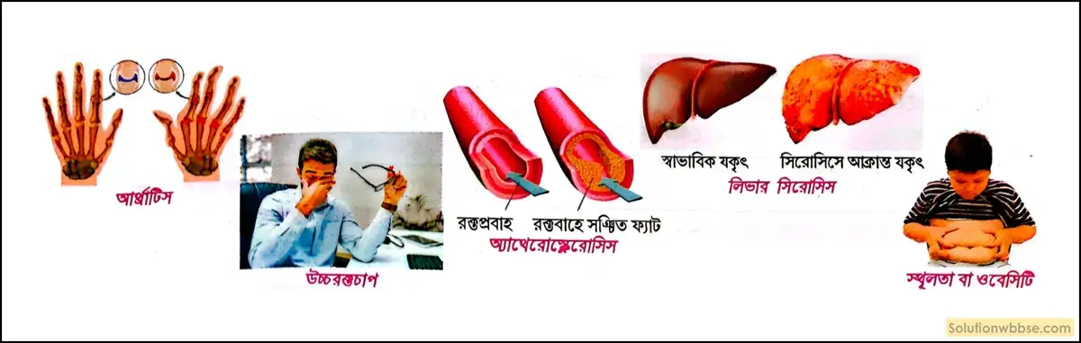 মানবদেহের বিপাকীয় সমস্যা