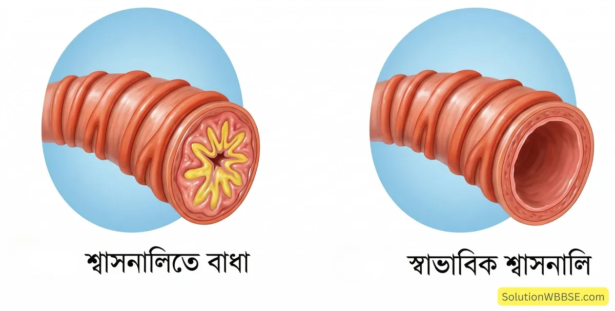 শ্বাসনালিতে বাধা এবং স্বাভাবিক শ্বাসনালি